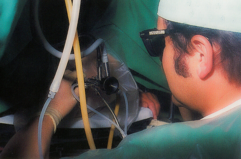 Erste endoskopische Tumorzerstörung mit einem Neodym-YAG-Laser (1. Juni 1976, Alfons Hofstetter)